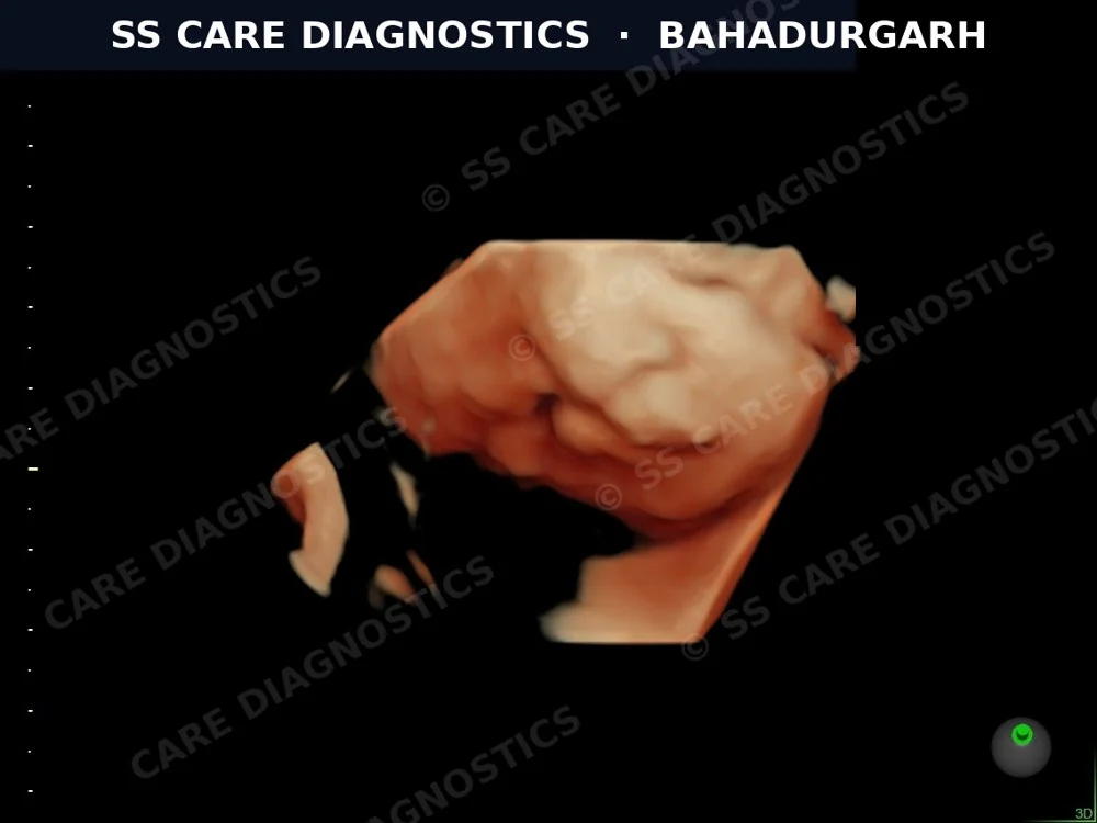 USG Scan Case