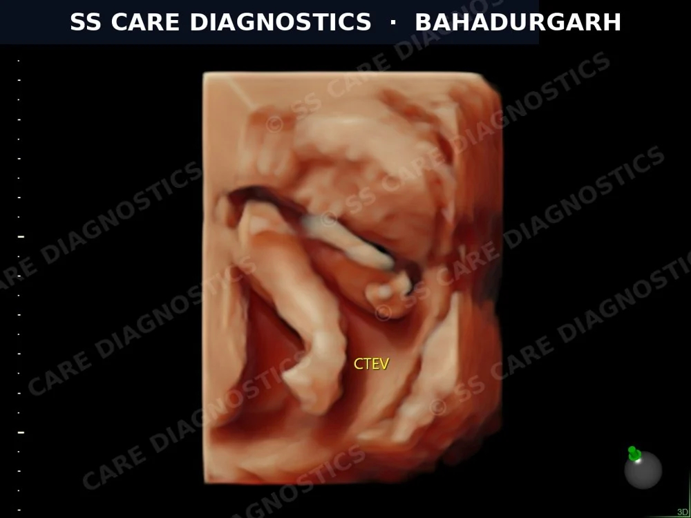 USG Scan Case