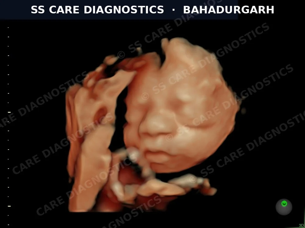 USG Scan Case