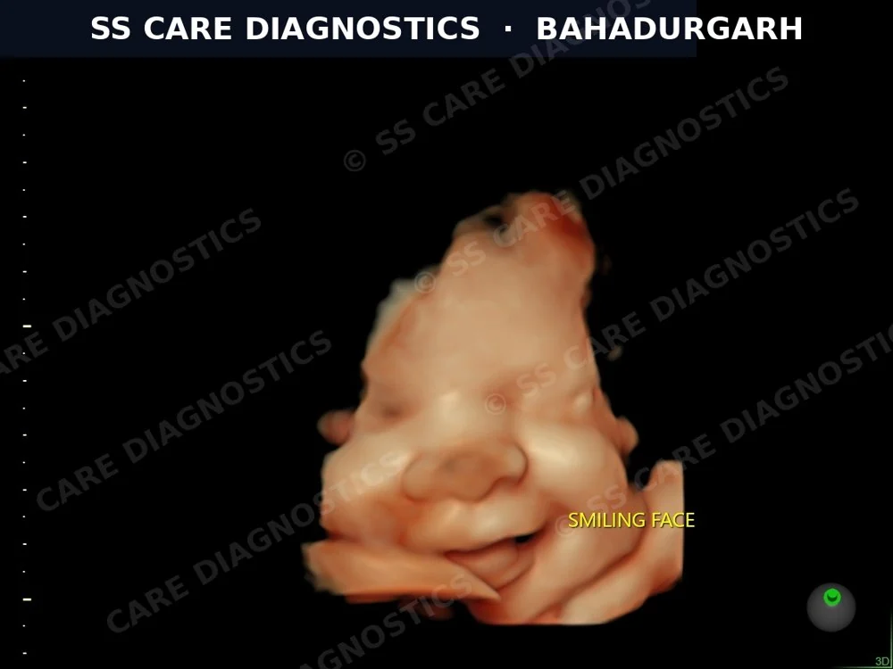 USG Scan Case
