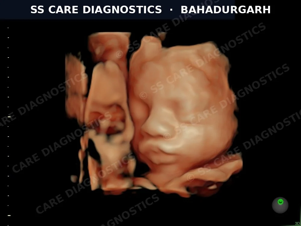 USG Scan Case