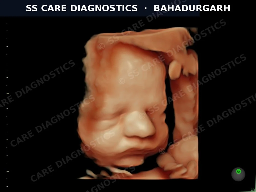 USG Scan Case