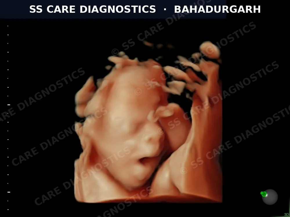 USG Scan Case