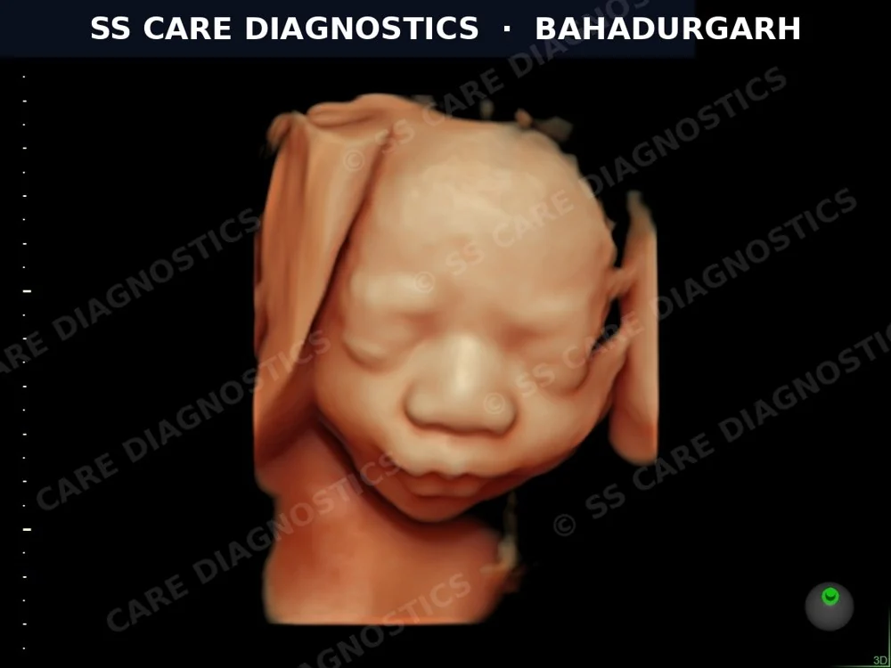 USG Scan Case