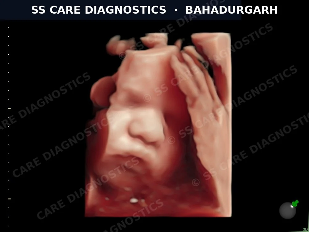 USG Scan Case