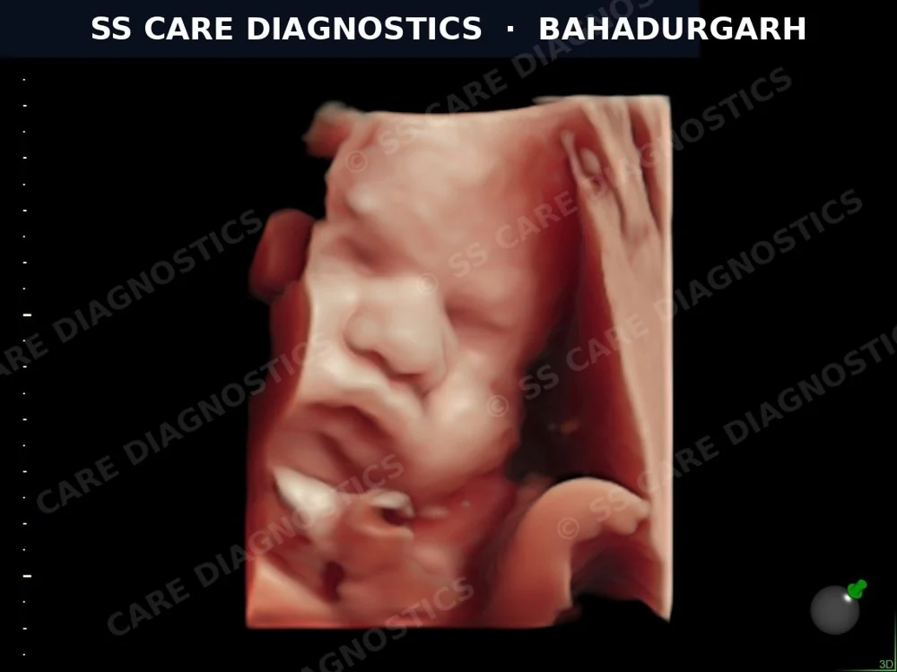 USG Scan Case