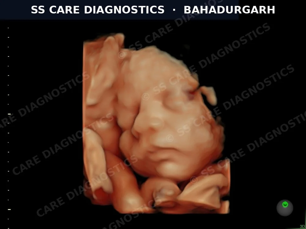 Third-Trimester 3D Imaging