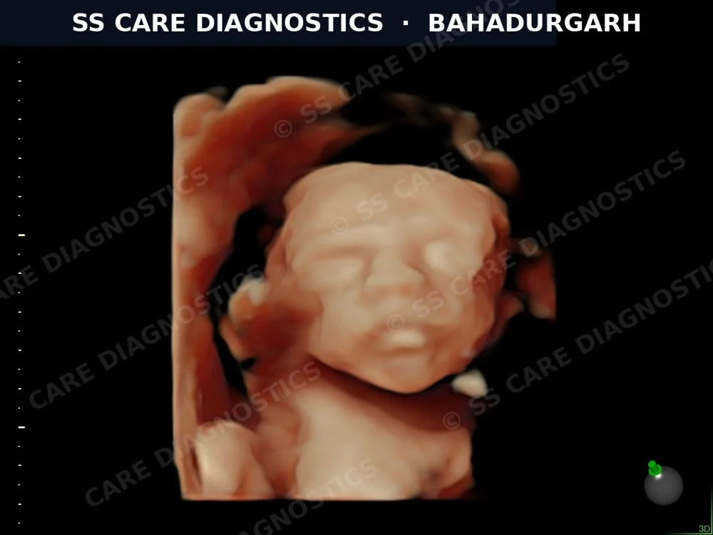High-Definition 4D Imaging
