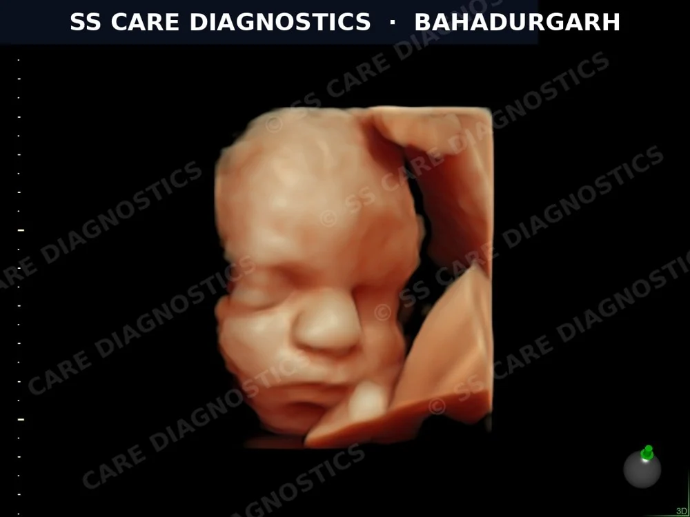 3D Fetal Face — Detailed View