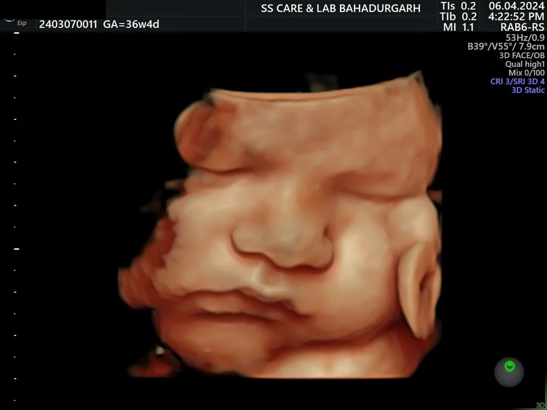 3D Fetal Face Portrait