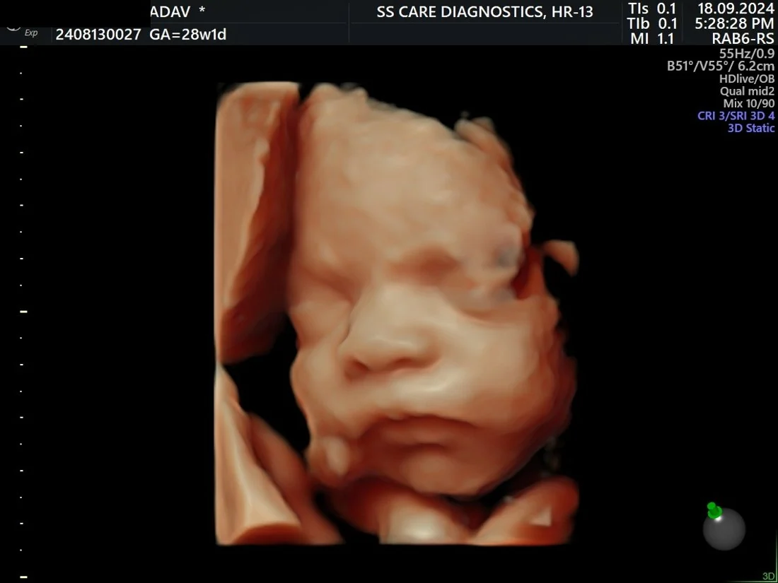 4D Fetal Face Study
